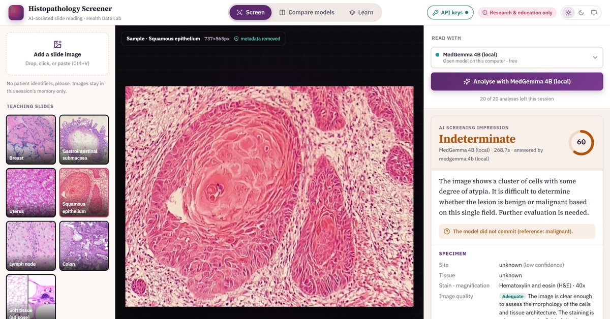 Histopathology Screener with MedGemma